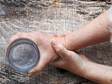 Parkinson-Früherkennung: Warum die ersten Anzeichen oft unbemerkt bleiben