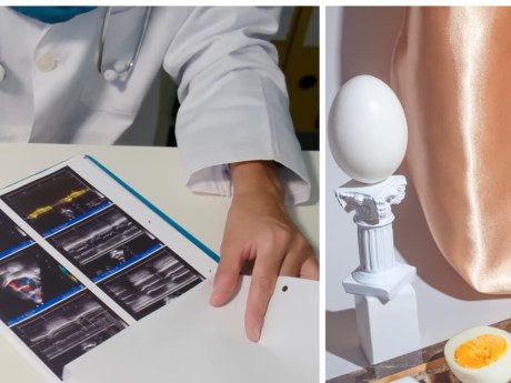 Kardiológ odporúča: varené či pošírované vajcia sú šetrnejšie k srdcu