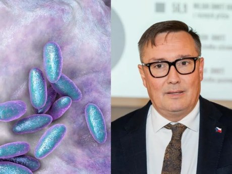 Plicní mor na Sibiři: český pneumolog hodnotí riziko pro Evropu