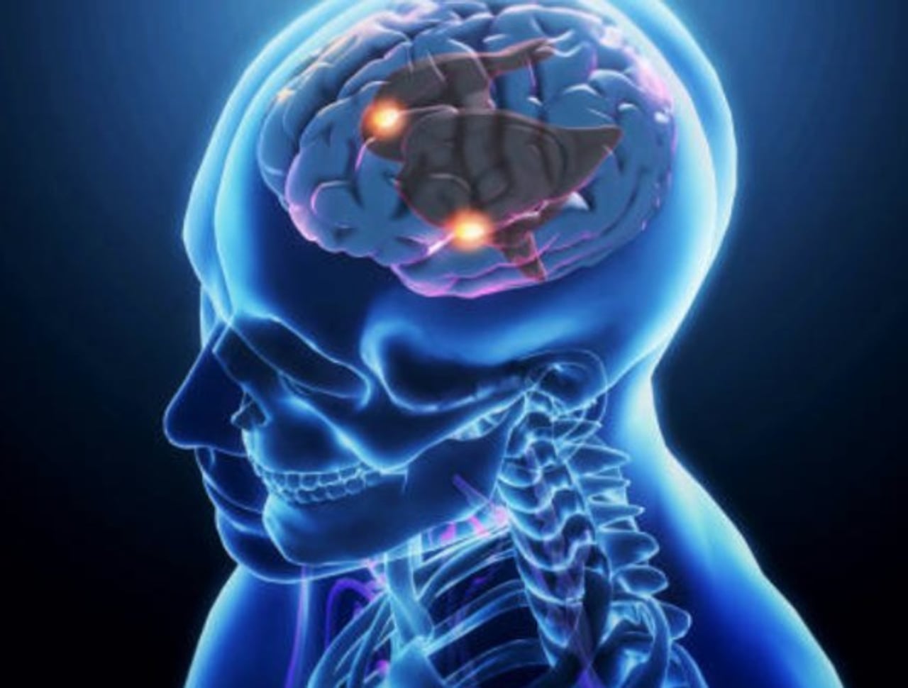Estudio vincula los ultraprocesados con más señales de daño cerebral