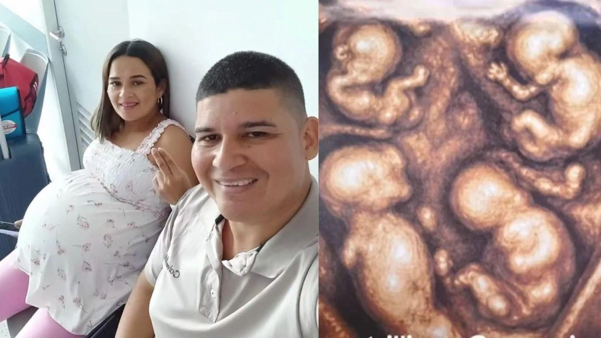 Nacieron en Medellín cuatro bebés idénticos y estables: el caso excepcional que sorprende a Colombia
